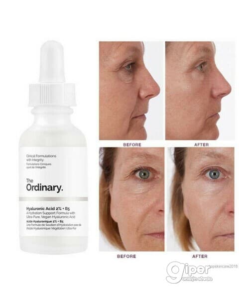 Gialuron kislotaly 2% we B5 witaminli syworotka The Ordinary - "Hyaluronic Acid 2% + B5", 30 ml