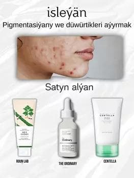 Ýüzdäki pigmentasiýany we düwürtükleri aýyrmak toplum